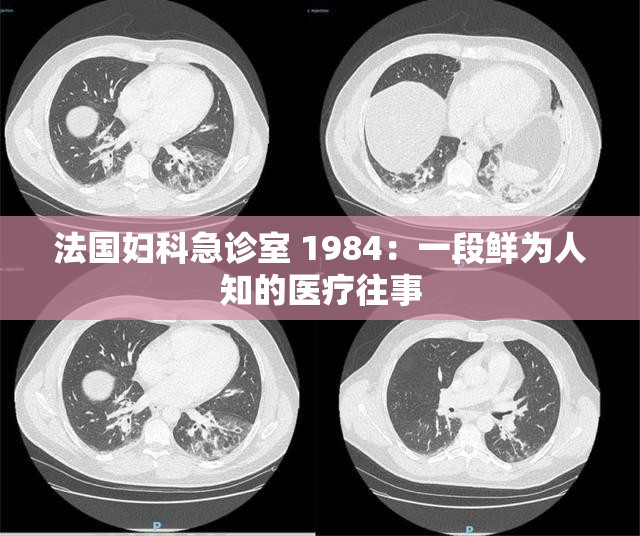 法国妇科急诊室 1984：一段鲜为人知的医疗往事