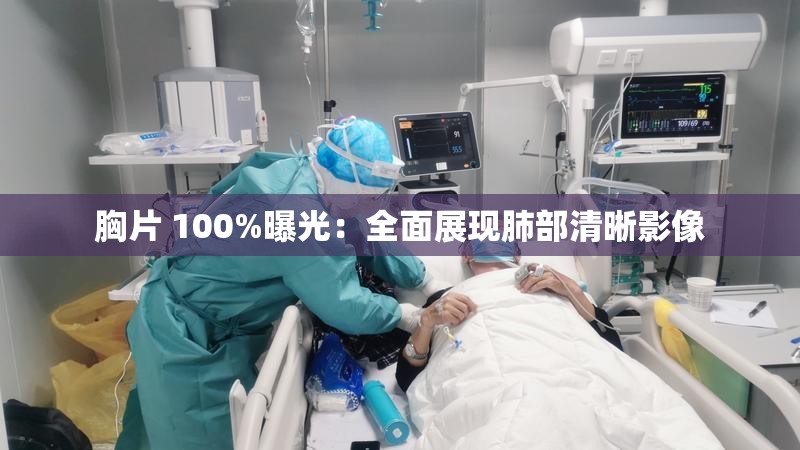 胸片 100%曝光：全面展现肺部清晰影像