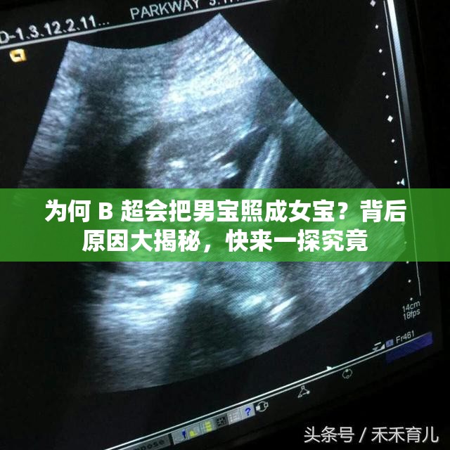 为何 B 超会把男宝照成女宝？背后原因大揭秘，快来一探究竟