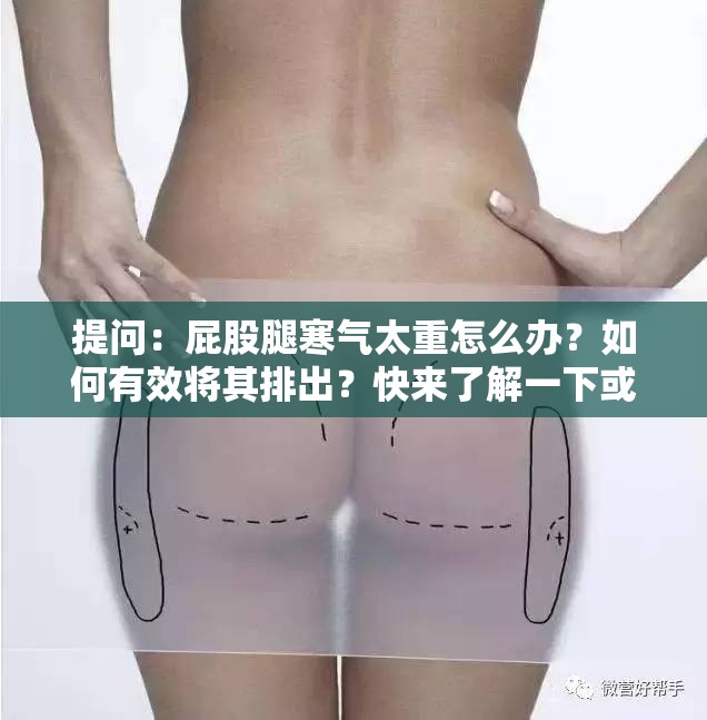 提问：屁股腿寒气太重怎么办？如何有效将其排出？快来了解一下或者：屁股腿寒气太重怎么排出来？这些方法你一定要知道