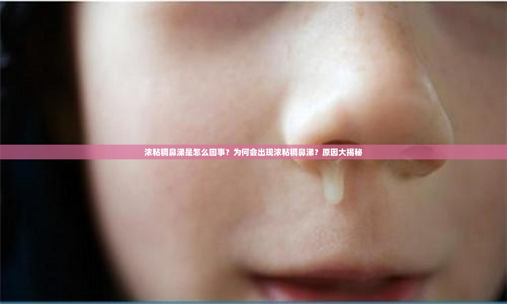 浓粘稠鼻涕是怎么回事？为何会出现浓粘稠鼻涕？原因大揭秘
